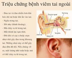 Viêm khoang tai ác tính - Ảnh minh họa 3