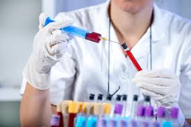 Xét nghiệm đè nén Clonidine - Ảnh minh họa 1