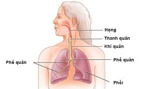 Viêm thanh khí phế quản cấp - Ảnh minh họa 3