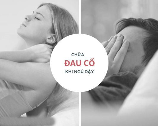 Đau cổ  - Ảnh minh họa 3