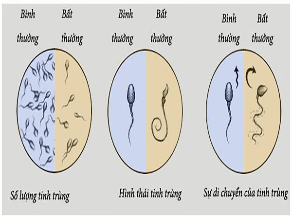 Ít tinh trùng - Ảnh minh họa 1