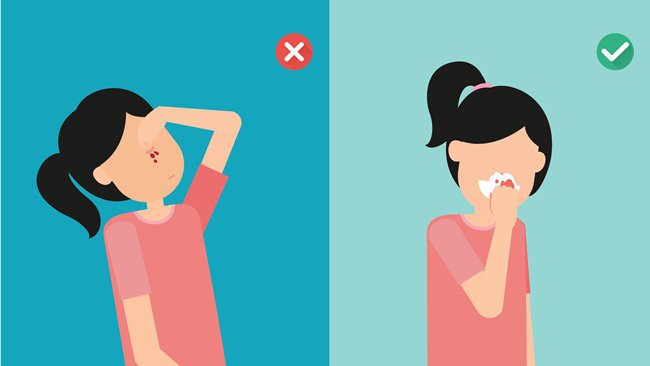 Những sai lầm trong sơ cứu khi chảy máu cam