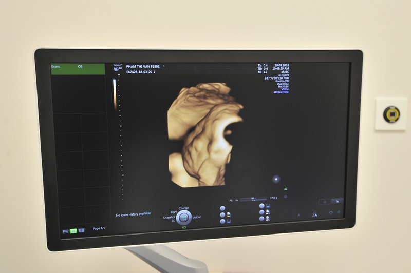 Các mốc siêu âm thai quan trọng