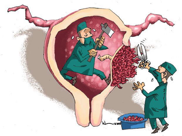 Để tránh gặp biến chứng nguy hiểm của rau cài răng lược - Sản phụ cần làm gì?