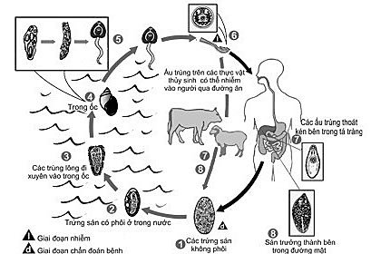 BỆNH SÁN LÁ GAN: NGUYÊN NHÂN, TRIỆU CHỨNG, CÁCH PHÒNG NGỪA