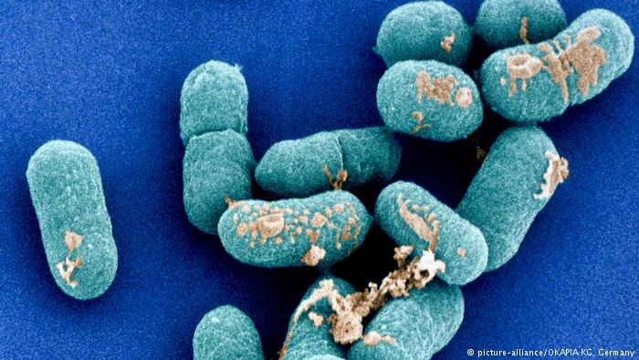 Listeriosis - Hình ảnh minh họa