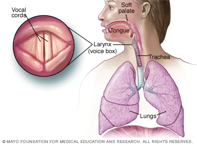 Laryngitis - Hình ảnh minh họa