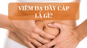 Acute gastritis - Hình ảnh minh họa