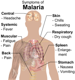 Malaria - Hình ảnh minh họa