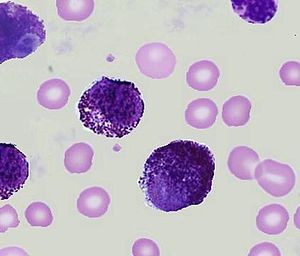 Mast cell - Hình ảnh minh họa