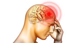 Áp xe não - Hình ảnh minh họa