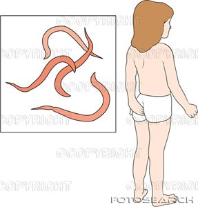 Nhiễm giun kim - Hình ảnh minh họa