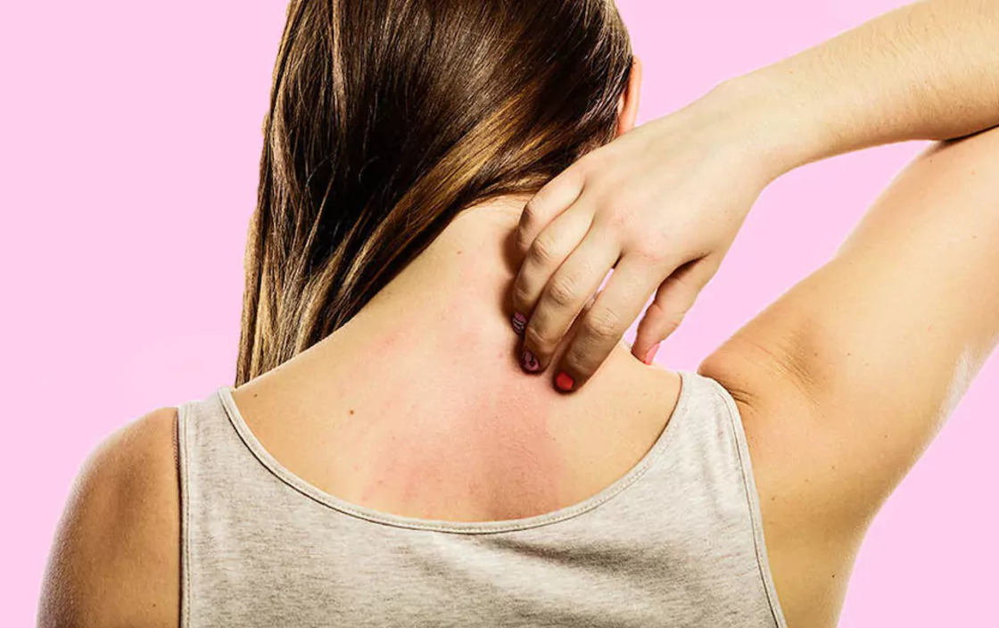 Ngứa - Hình ảnh minh họa