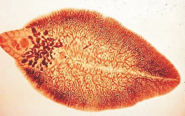 Nhiễm sán lá gan - Hình ảnh minh họa