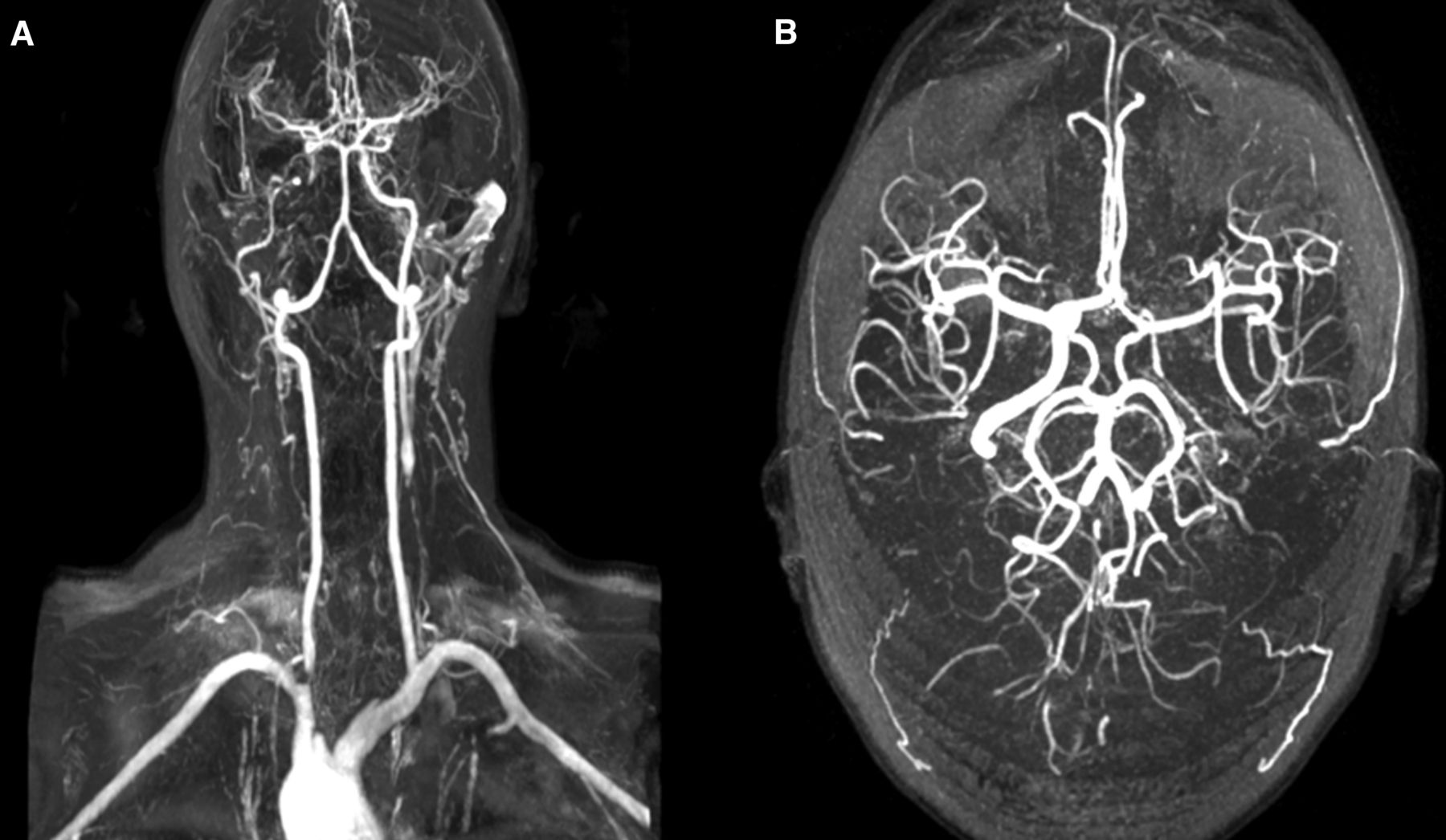 Mất mạch - Hình ảnh minh họa