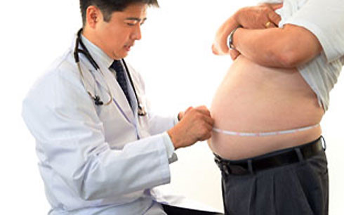 Béo phì - Hình ảnh minh họa