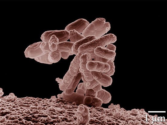 Nhiễm trực khuẩn Pseudomonas - Hình ảnh minh họa