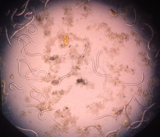 Nhiễm giun lươn - Hình ảnh minh họa