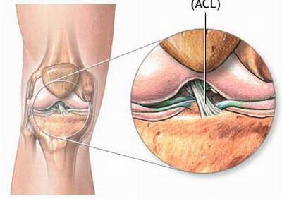 Nhiễm trùng khớp gối - Hình ảnh minh họa