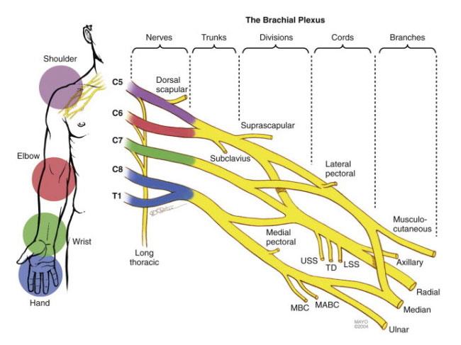 Plexus lesion arm - Hình ảnh minh họa
