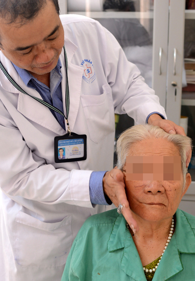 Bell\'s Palsy - Hình ảnh minh họa