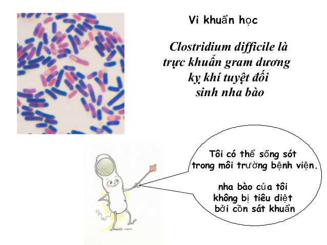 Nhiễm vi khuẩn Clostridium difficile (C. Diff) - Hình ảnh minh họa