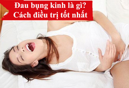 Primary Dysmenorrhea - Hình ảnh minh họa