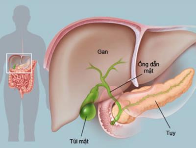 Pancreatic cyst - Hình ảnh minh họa