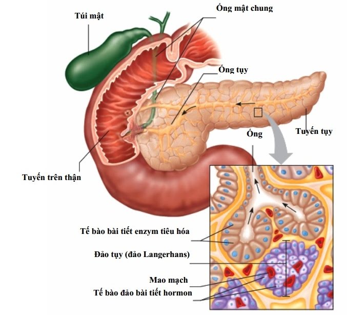 Pancreatic cancer - Hình ảnh minh họa