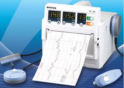 Vì sao cần phải theo dõi tim thai trong quá trình chuyển dạ bằng monitor - ảnh 1