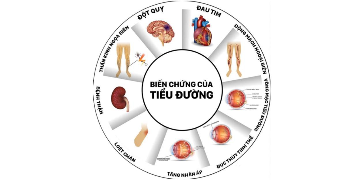 Bệnh tiểu đường type 2: Nguyên nhân, biến chứng và phòng bệnh - ảnh 2