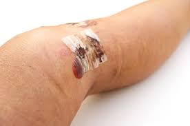 Rối loạn hoang tưởng - Hình ảnh minh họa