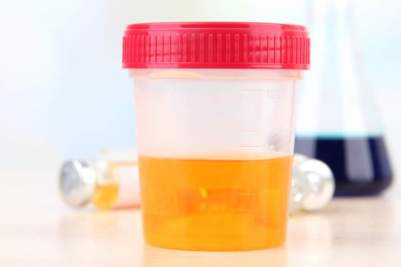 Dấu hiệu của bệnh viêm tiền liệt tuyến ở nam giới - ảnh 1