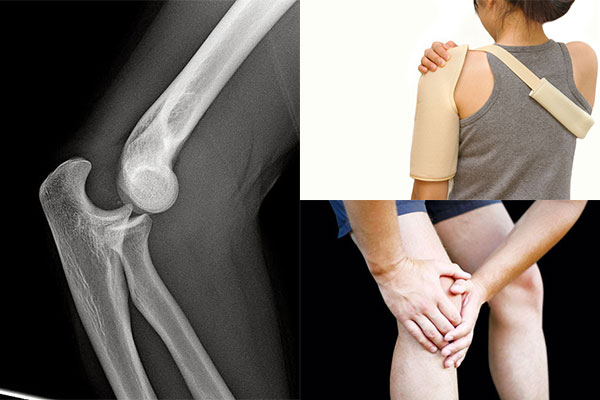 Sai khớp đầu xương quay - Hình ảnh minh họa