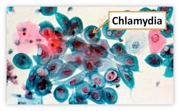 Bệnh lây nhiễm qua đường tình dục chlamydia, lậu và giang mai - ảnh 1