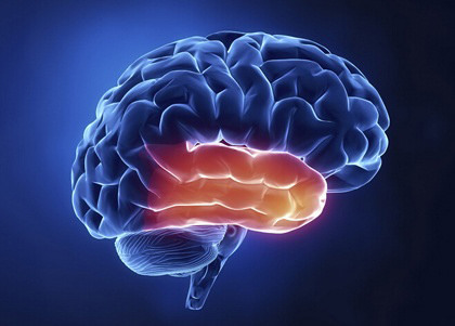 Temporal Lobe Epilepsy - Hình ảnh minh họa