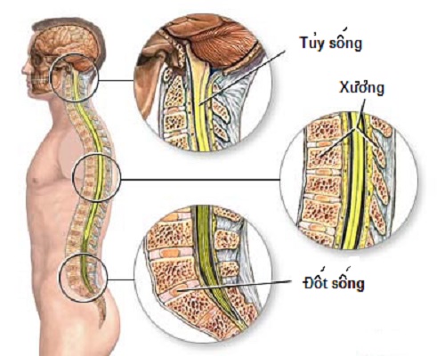 Transverse myelitis - Hình ảnh minh họa