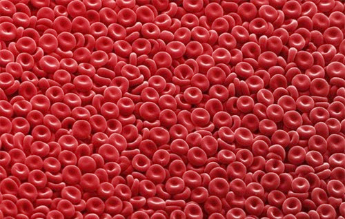 Tăng tiểu cầu nguyên phát - Hình ảnh minh họa