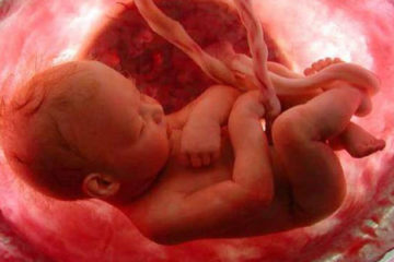 Thai chết lưu - Hình ảnh minh họa