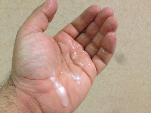 Tinh trùng loãng - Hình ảnh minh họa