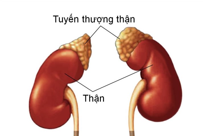 Ung thư tuyến thượng thận - Hình ảnh minh họa