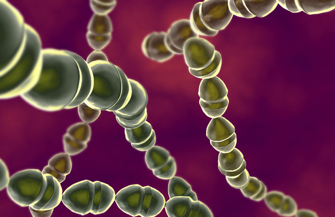 Viêm màng não do phế cầu - Hình ảnh minh họa