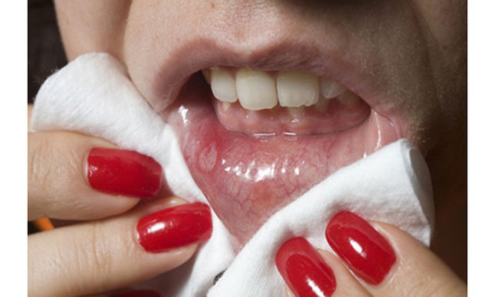 Vết thương thủng ở miệng - Hình ảnh minh họa