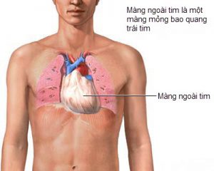 Viêm màng ngoài tim - Hình ảnh minh họa