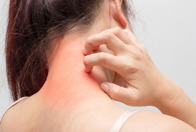 Chụp mạch vành - Trong Chẩn đoán và điều trị bệnh mạch vành - ảnh 2