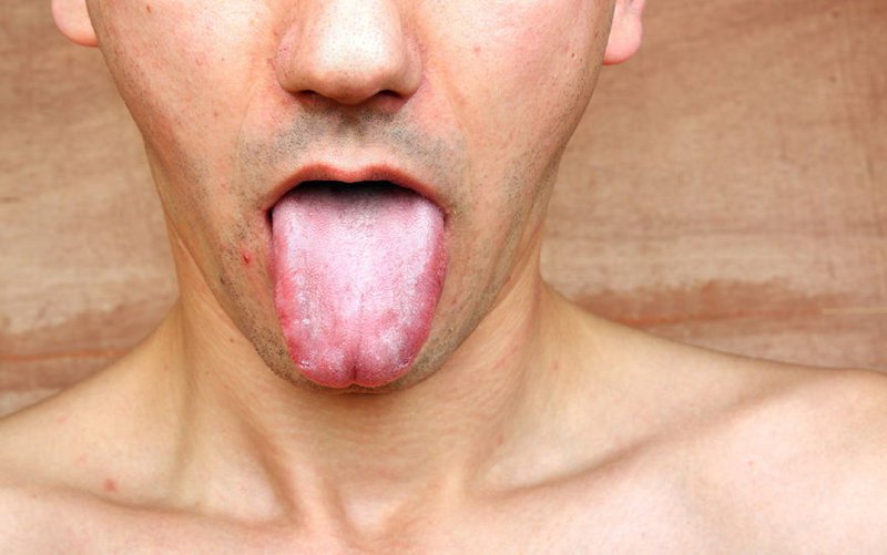 Bệnh giang mai: Nguyên nhân, đường lây, dấu hiệu nhận biết - ảnh 1