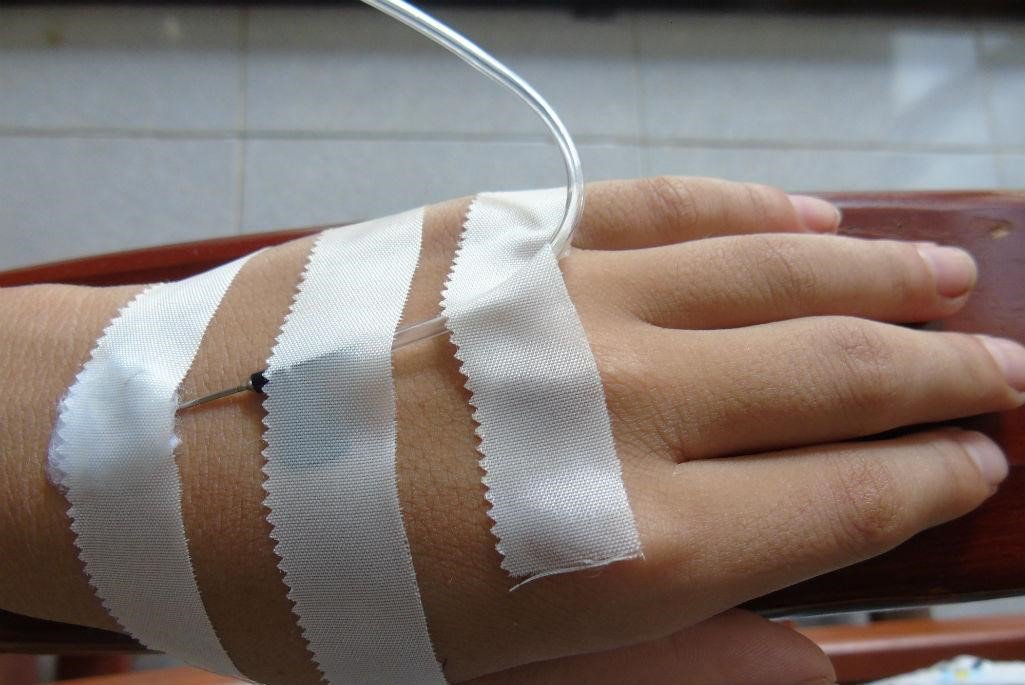 Sốt virus ở trẻ em và người lớn: Cảnh giác với thói quen tự truyền nước - ảnh 2