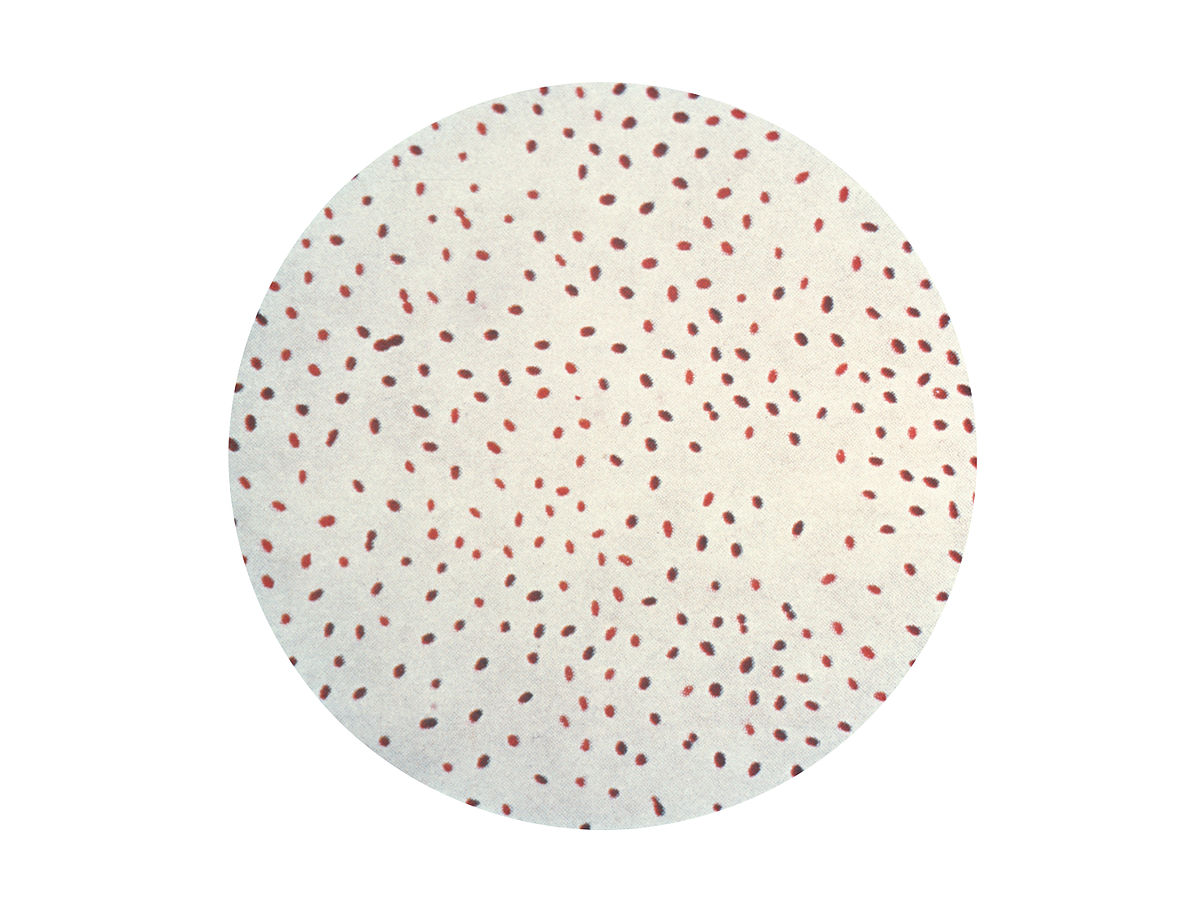 Brucella - Hình ảnh minh họa