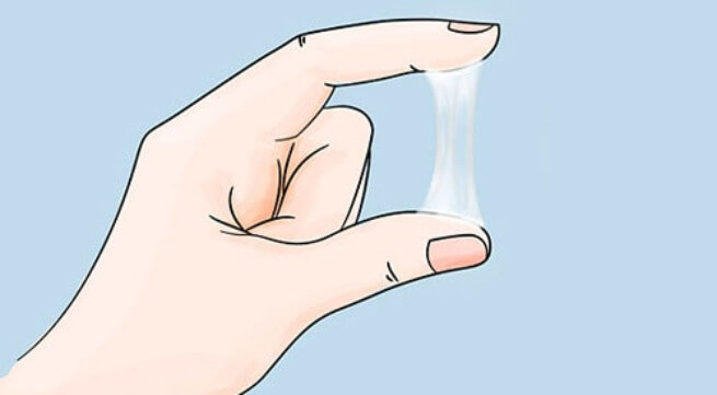Bệnh huyết trắng là bệnh gì? Huyết trắng có gây nên biến chứng ung thư cổ tử cung hay - ảnh 1