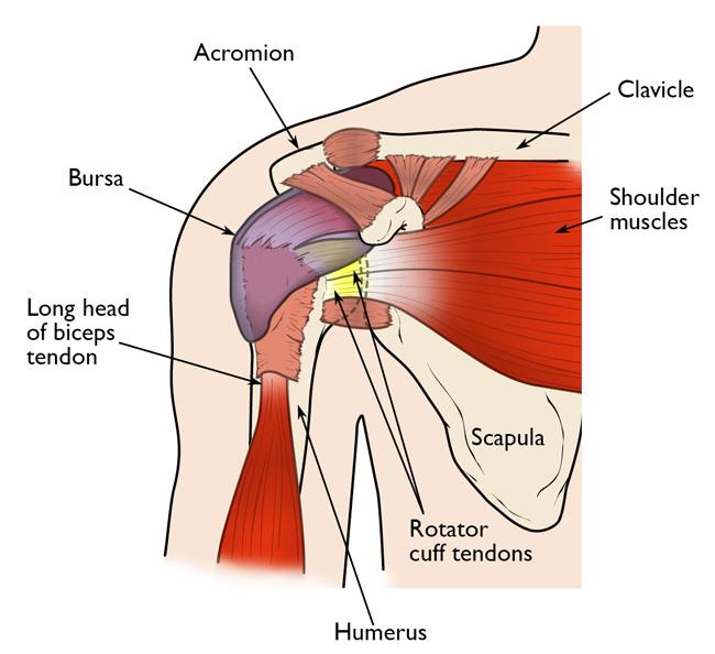 Hội chứng Rotator cuff - Hình ảnh minh họa